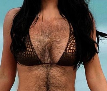 女子做丰胸换来乳房长满恐怖黑毛
