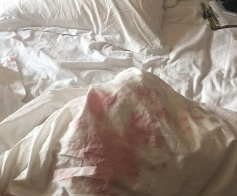 旅客弄脏被套要赔550元 高价索赔成酒店业潜规则