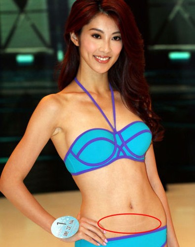 准港姐小腹现刀疤被猜生子